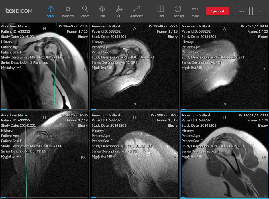 TigerText Announces Deeper Integration with BOX to Provide Healthcare Teams with Secure Messaging Capabilities for DICOM Image Collaboration